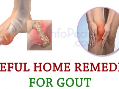 Useful Home Remedies for Gout