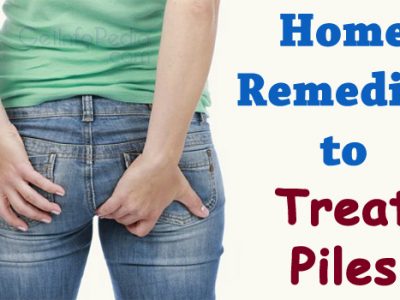 Home Remedies to Treat Piles
