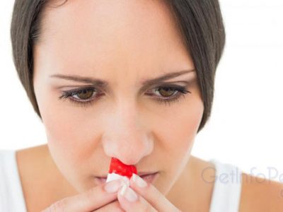 10 Quick Home Remedies to Stop Nose Bleeding