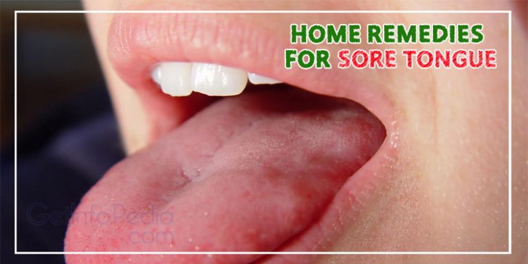 Home Remedies For Treating Sore Tongue