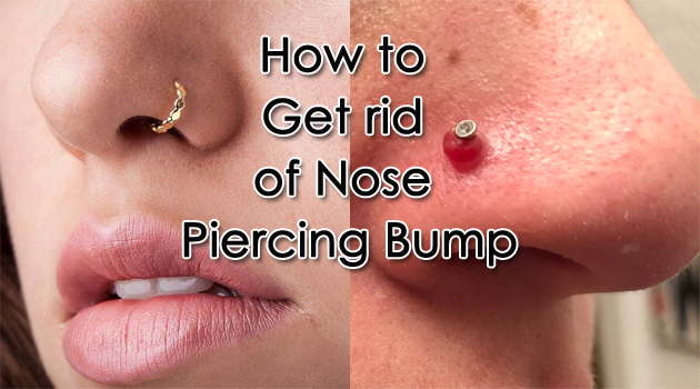 how-to-get-rid-of-nose-piercing-bump-nose-piercing