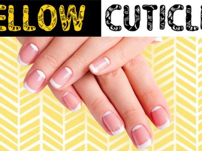 Yellow cuticles