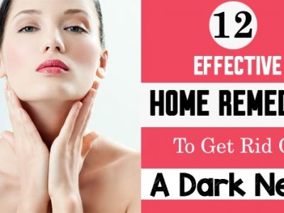 Home Remedies To Get Rid Of A Dark Neck