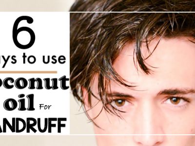 Coconut Oil for Dandruff