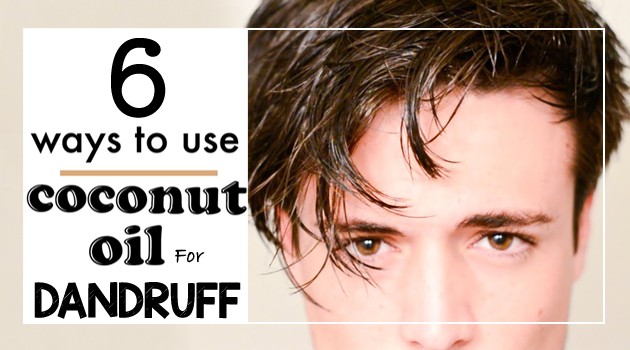 Coconut Oil for Dandruff