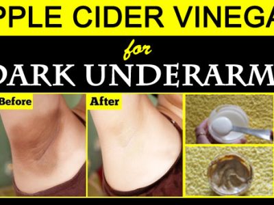 Apple Cider Vinegar for Dark Underarms