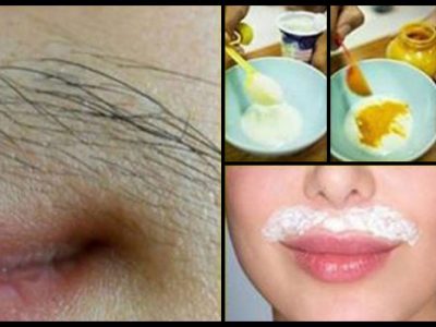 How To Remove Upper Lip Hair Naturally At Home