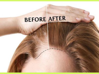 Visible Hair Growth in Just 3 Days Naturally