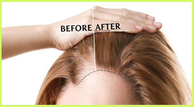 Visible Hair Growth in Just 3 Days Naturally