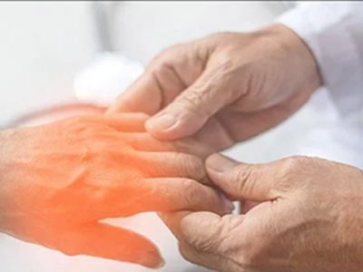 10 Causes of Peripheral Neuropathy