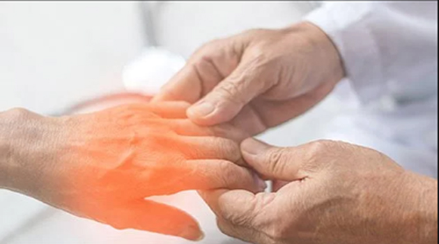 10 Causes of Peripheral Neuropathy