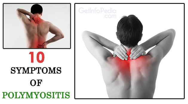 10 SYMPTOMS OF POLYMYOSITIS