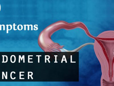 10 Symptoms of Endometrial Cancer