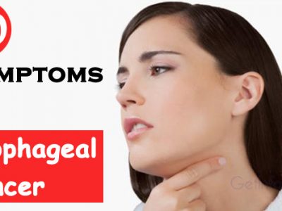 10 Symptoms of Esophageal Cancer