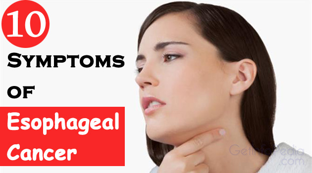 10 Symptoms of Esophageal Cancer