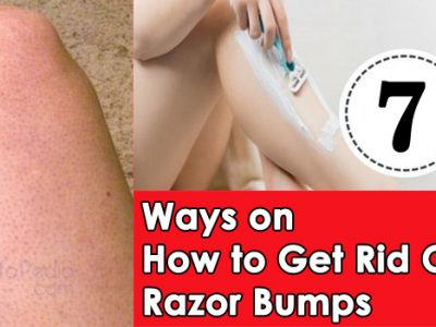 7 Ways on How to Get Rid Of Razor Bumps