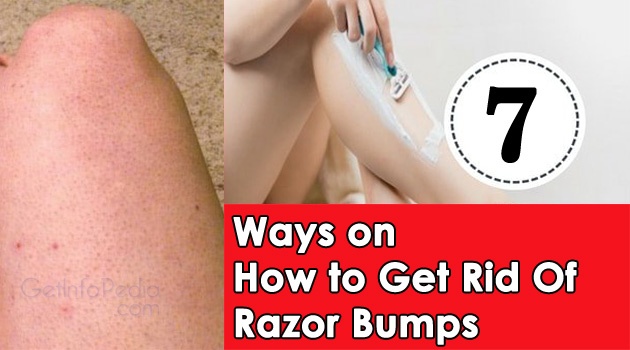 7 Ways on How to Get Rid Of Razor Bumps