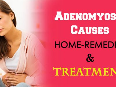 Adenomyosis Causes, Home-Remedies, and Treatment