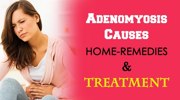 Adenomyosis Causes, Home-Remedies, and Treatment