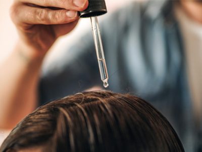 Cure Dandruff Permanently