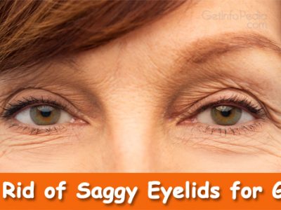 saggy eyelids