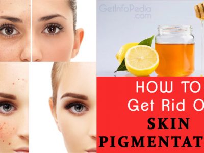 Skin Pigmentation