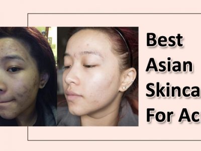 Best Asian Skincare for Acne