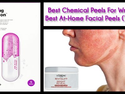 Best Chemical Peels