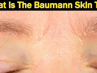 baumann skin type