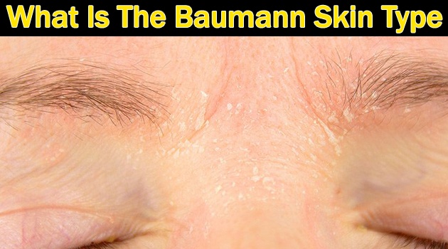 baumann skin type