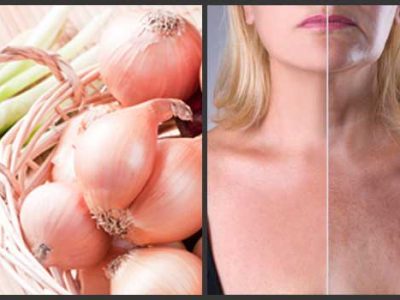 Benefits Of Onion On Skin