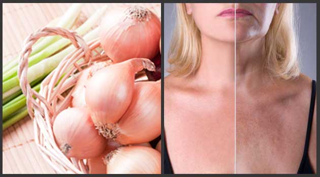 Benefits Of Onion On Skin