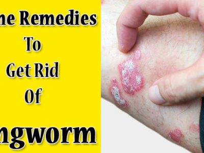 home remedies to get rid of ringworm