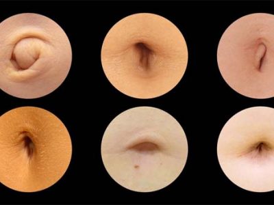 Navel Shapes And Health