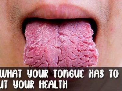 See What Your Tongue Has to Say About Your Health