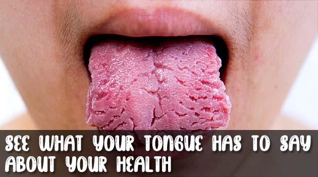See What Your Tongue Has to Say About Your Health