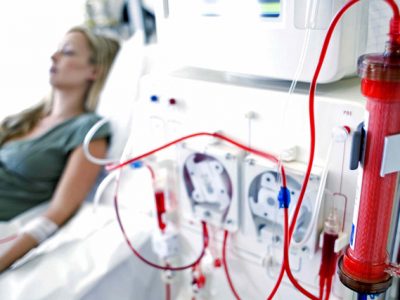 Dialysis and its Side Effects - GetInfopedia.com
