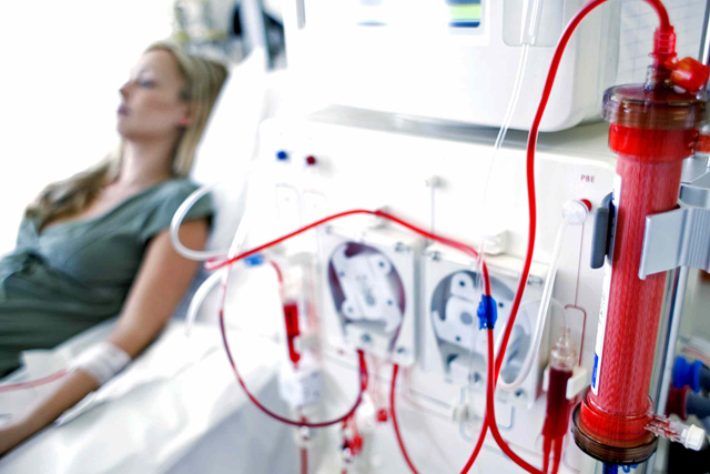 Dialysis: Top 5 Side Effects to Kidney Disease Patients Dialysis and its Side Effects - GetInfopedia.com
