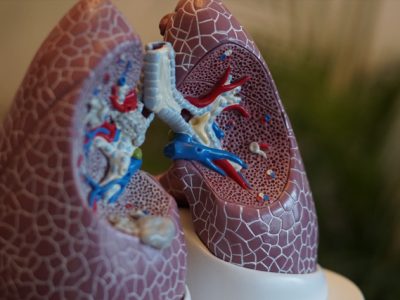 Lung Cancer