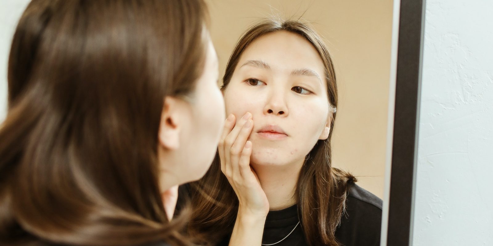 6 Surprising Reasons Your Face Break Out