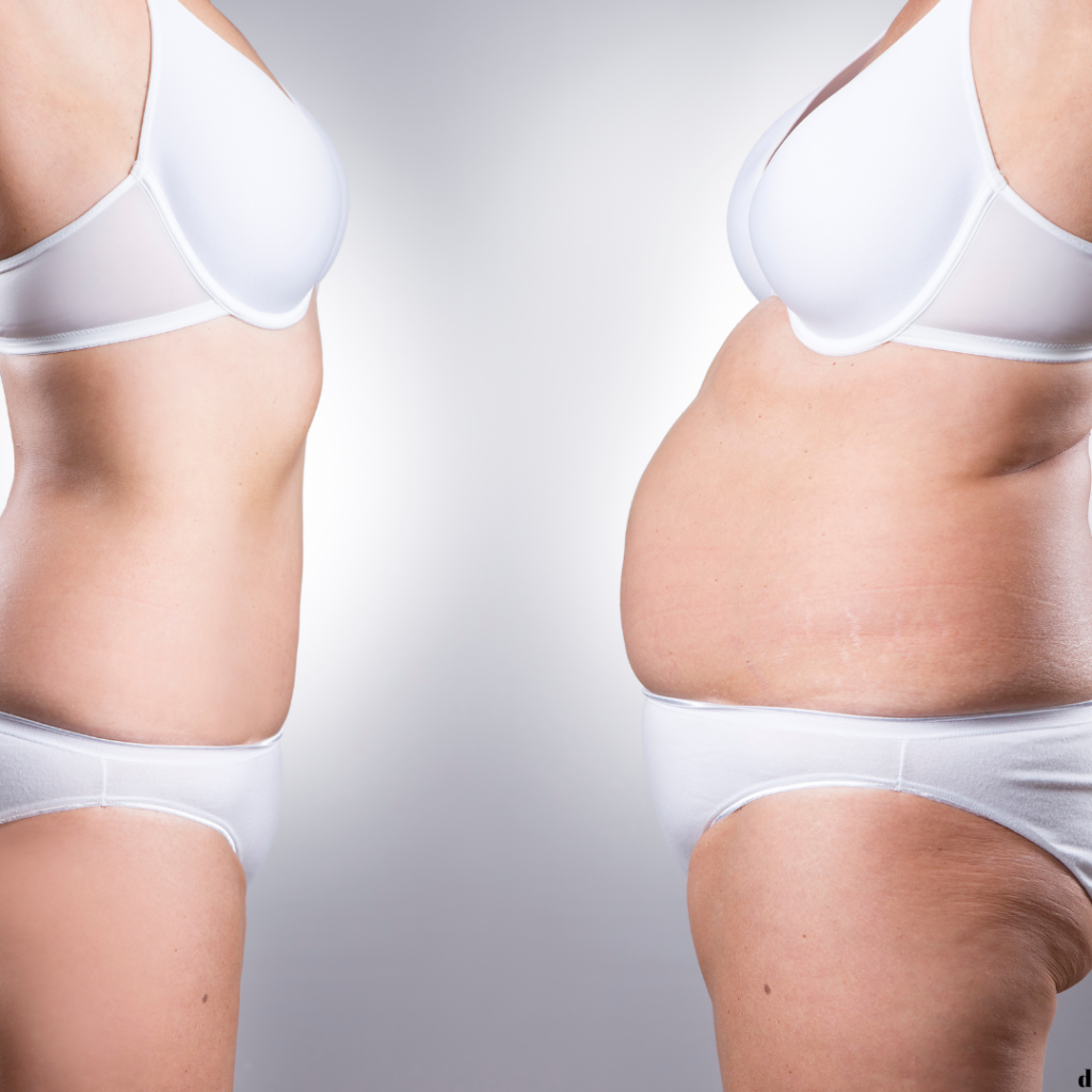 Effective Weight Loss Tips for Obese Women – A Guide to a Healthier You